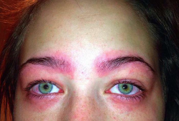 Allergie gegen Henna für Augenbrauen