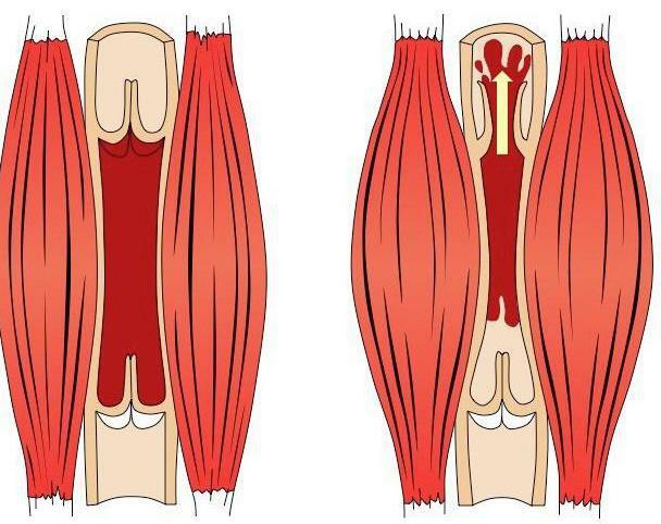 venous valves of the lower limbs of man