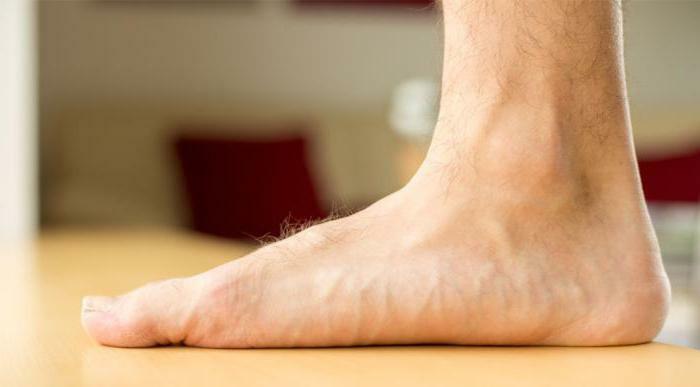 øvelser med flatfoot