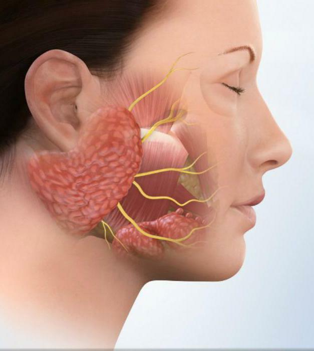causas de la inflamación de la glándula salival parótida