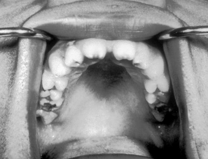 foto zubov