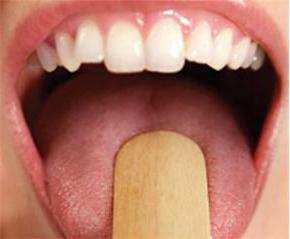 rashes of the oral cavity