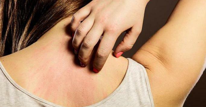 alergija na fotografijo vratu