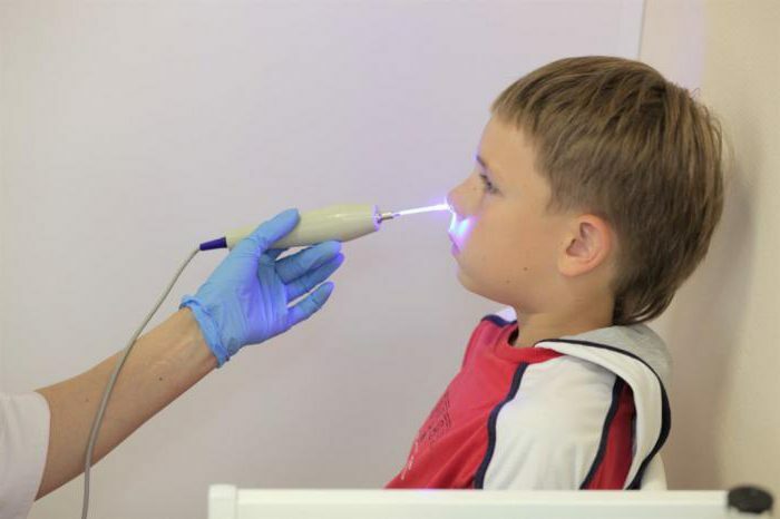 treatment of adenoids by laser in children reviews