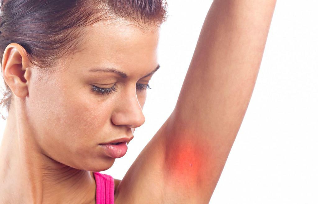 Pencegahan alergi terhadap deodoran