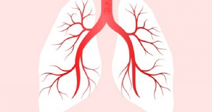 Peradangan bronkus pada bronkitis
