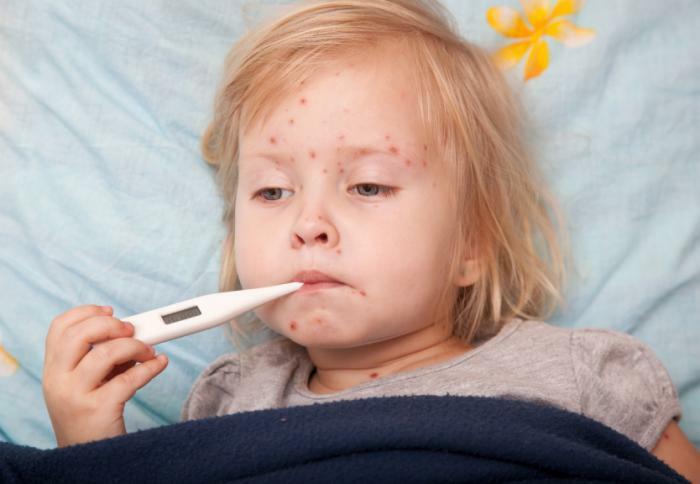 The first signs of chickenpox