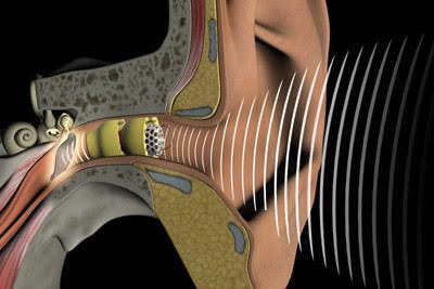 pregled intrakanalnih slušnih aparata
