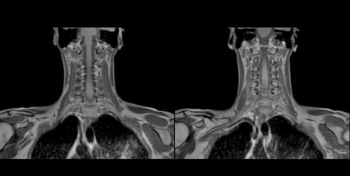 mr soft tissue neck that shows