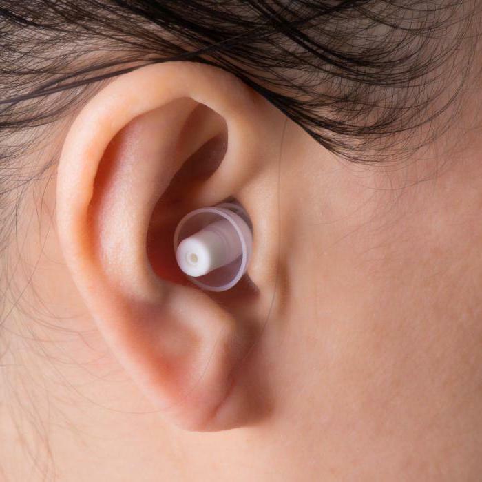 how to peel ears from sulfuric plugs