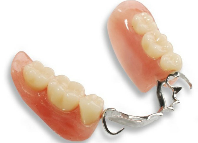 removable dental prosthesis