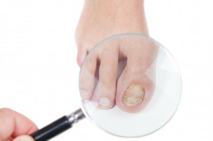 oil stop drug from nail fungus description of the drug