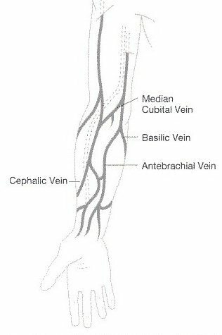 algoritmul de injectare intravenoasă