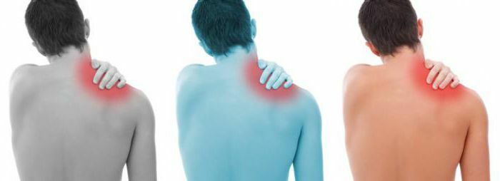 osteochondrosis of the cervical shoulder joint symptoms