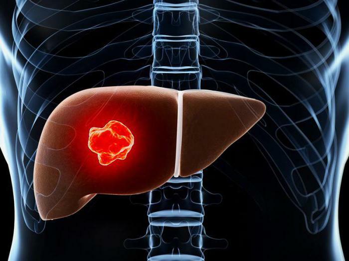 adenoma of the liver