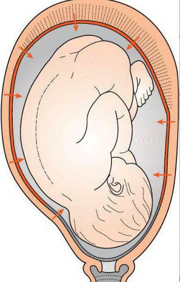 childbirth in the occipital presentation