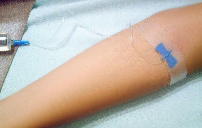 algoritmul de injectare intravenoasă