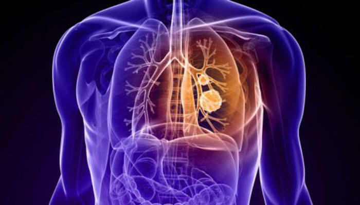 Classification of pulmonary tuberculosis