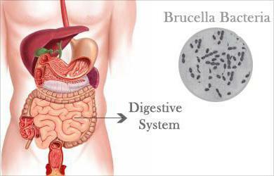 Brucelóza je