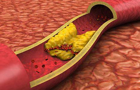 aké potraviny zvyšujú hladinu cholesterolu v krvi