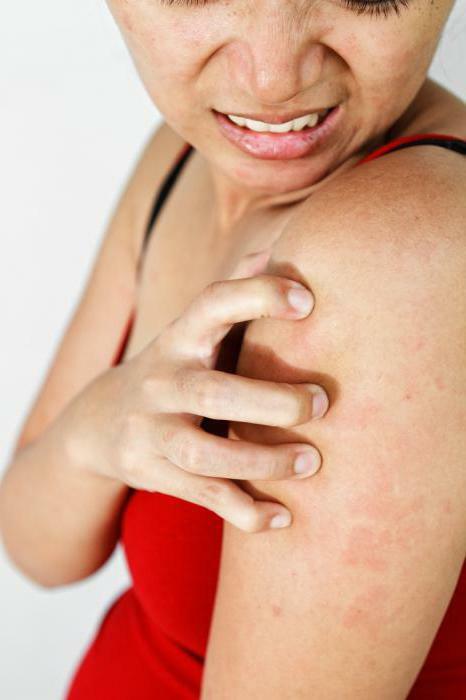 Allergy To An Adhesive Plaster On The Skin Symptoms Prevention And Treatment Features