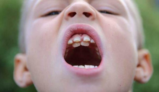 supercomplete hammas lapsi