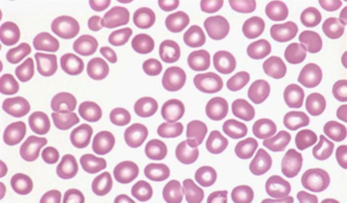thrombocytopenic purpura in adult clinic