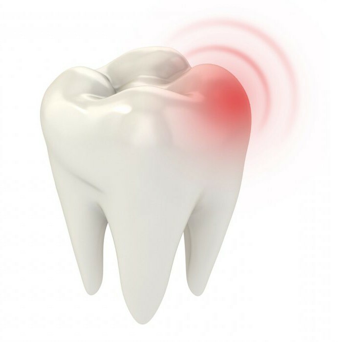 Pulpitis: Classification, Types, Clinic. Classification Of Methods Of ...