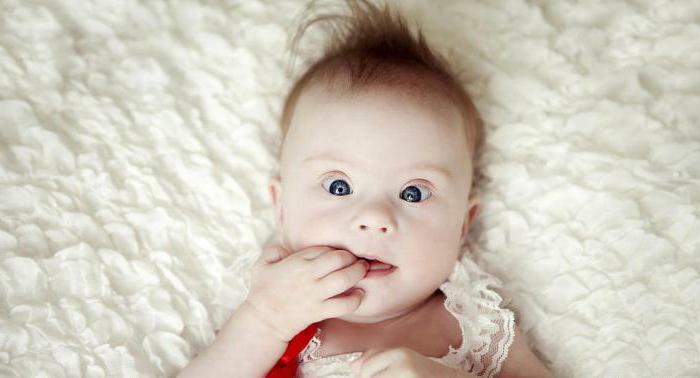 Down syndrome signs in newborns