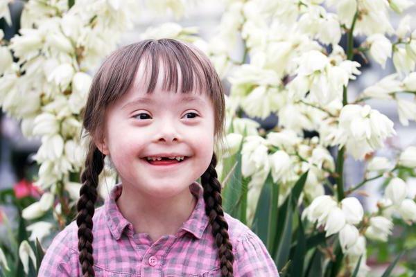 signs and symptoms of a down syndrome in a newborn