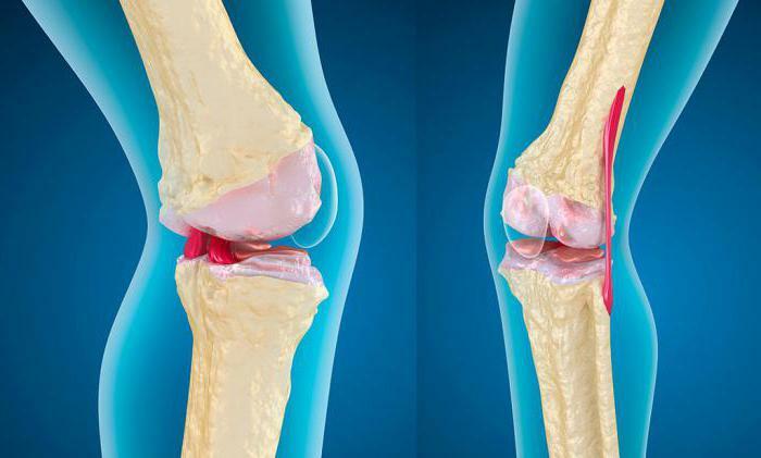 arthrosis of the knee joint muslim jamaldinov