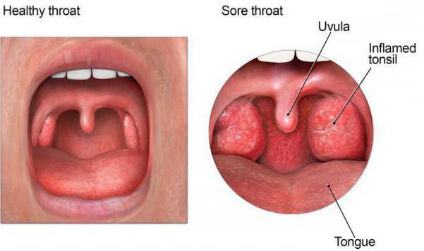 faryngosept cena