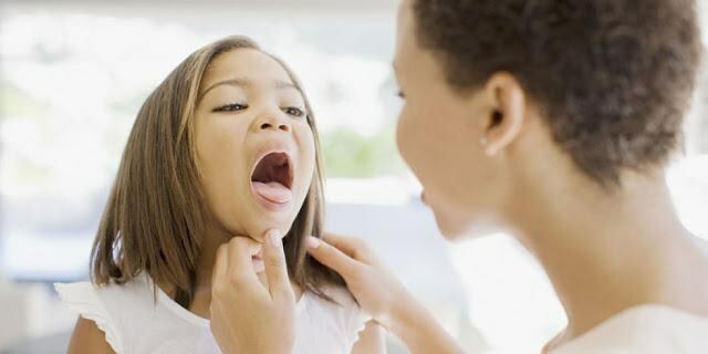 how to treat herpes sore throat in children