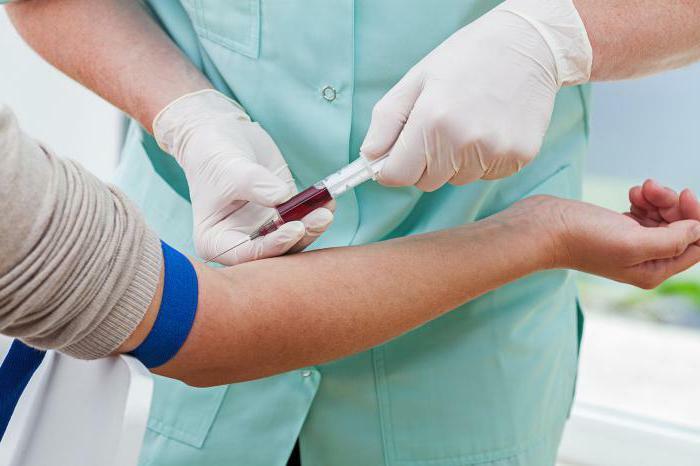 a blood test for urea and creatinine