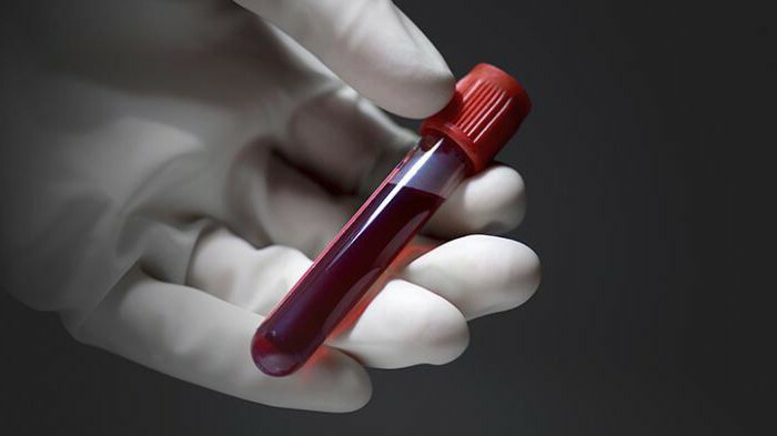 urgent blood test