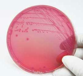 Escherichia coli in the smear: how serious is it?