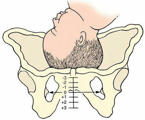 examinarea obstetrică externă a femeilor parturiente