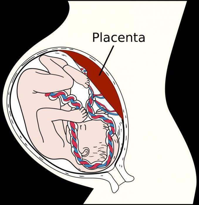 manual removal of the placenta