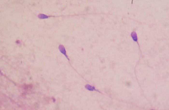 spermogram test