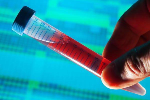 hct in the blood test is the norm for women
