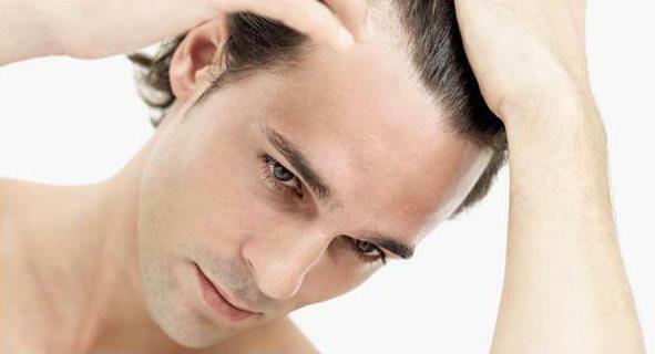 androgenic alopecia in men