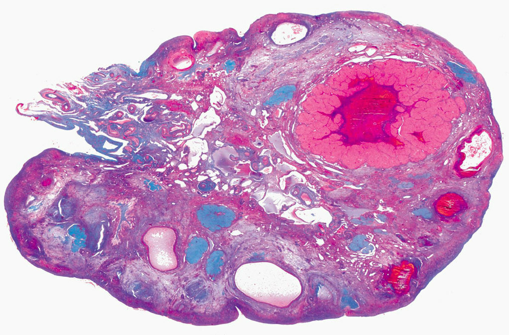 ovarian follicles, histology