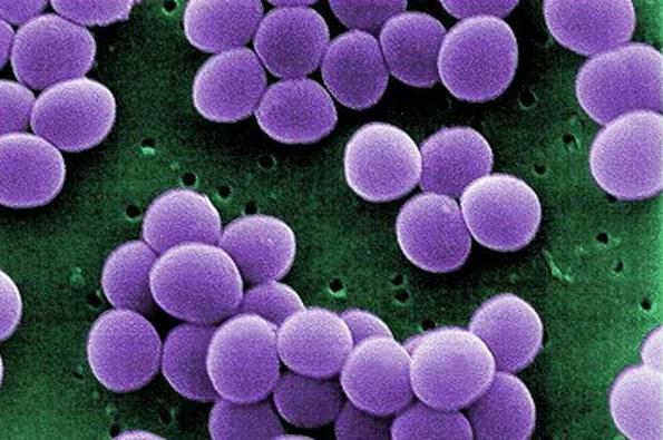 bacteriophage staphylococcus aureus with furunculosis reviews