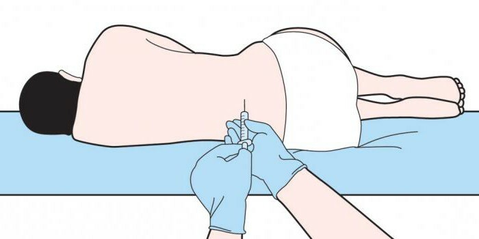 blockade of the lumbar spine