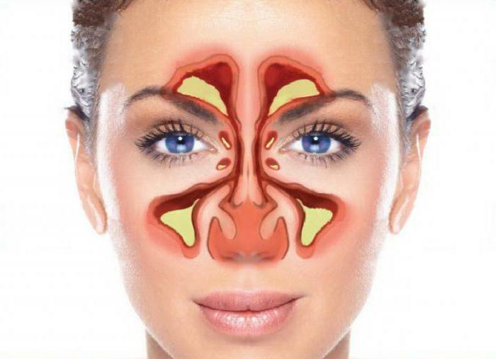 uzi sinuses of a nose at a genyantritis
