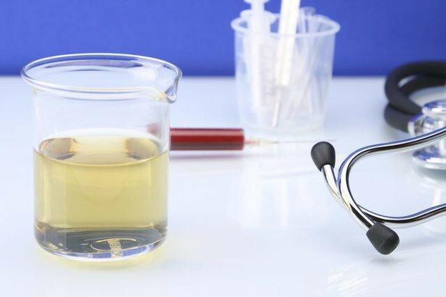 what kinds of urine tests and their characteristics