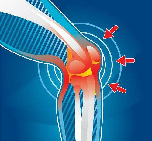 ligamentoza ligamentelor cruciate ale articulației genunchiului