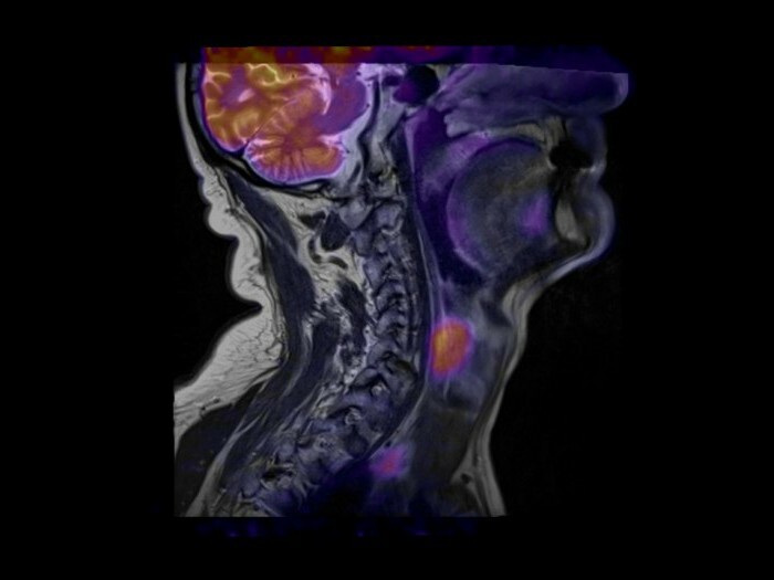 neck vessels that shows