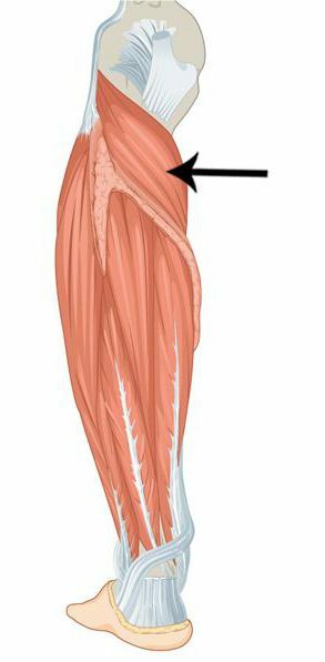 Popliteal sval