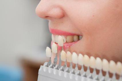 how to whiten tetracycline teeth